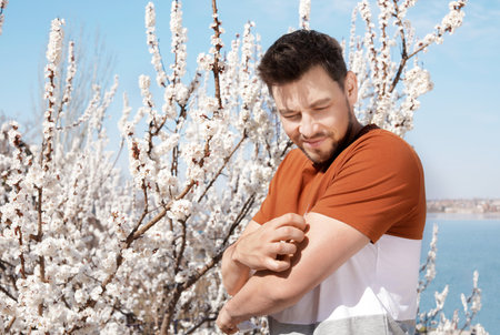 Man suffering from seasonal allergy outdoors, space for text