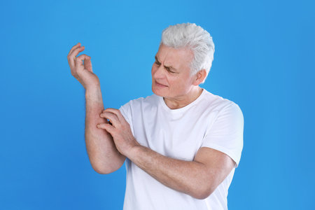 Senior man scratching forearm on color background. Allergy symptomの写真素材