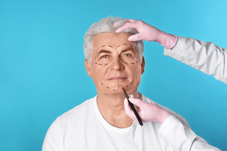 Doctor drawing marks on man's face for cosmetic surgery operation against blue backgroundの写真素材