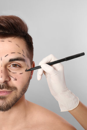 Doctor drawing marks on man's face for cosmetic surgery operation against grey background, closeupの写真素材