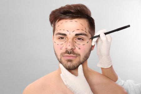 Doctor drawing marks on man's face for cosmetic surgery operation against grey backgroundの写真素材