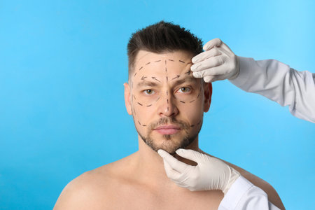 Doctor examining man's face before plastic surgery operation on blue backgroundの写真素材