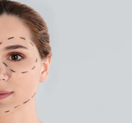 Woman with marks on face against gray background, space for text. Cosmetic surgeryの写真素材