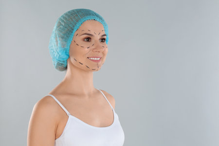 Portrait of woman with marks on face against gray background, space for text. cosmetic surgeryの写真素材