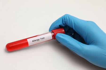 Doctor holding tube with label ALLERGY TEST on light background, closeupの写真素材