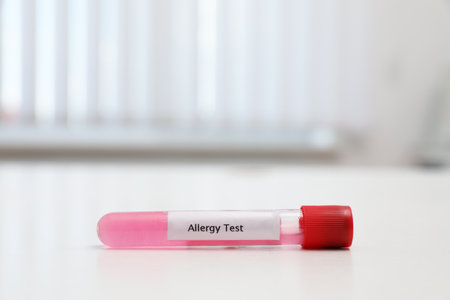 Tube with label ALLERGY TEST on white table, space for textの写真素材