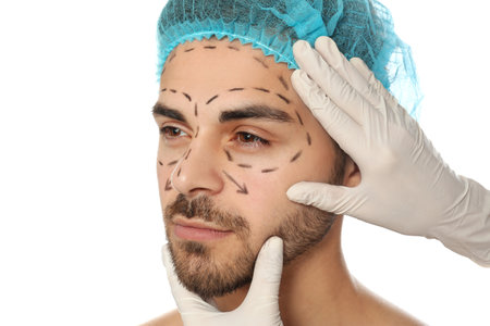 Doctor examining man's face with marker lines for plastic surgery operation on white backgroundの写真素材