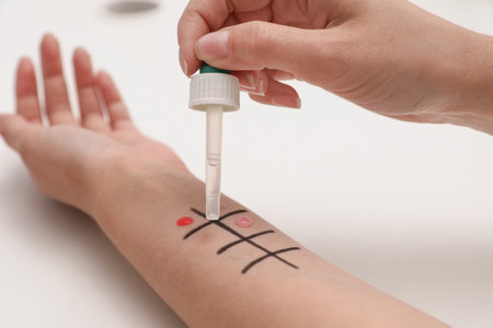 Patient undergoing skin allergy test at light table, closeupの写真素材