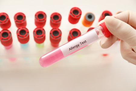 Doctor holding tube with label ALLERGY TEST over table, closeupの写真素材