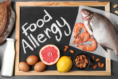 Chalkboard with phrase FOOD ALLERGY and different products on dark gray background, flat layの写真素材