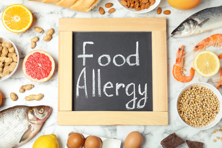 Chalkboard with words FOOD ALLERGY and different products on white marble table, flat layの写真素材