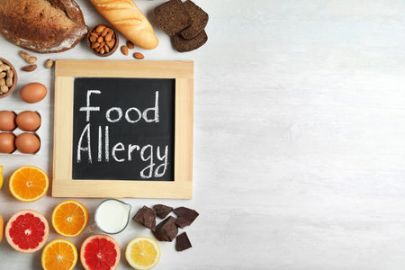 Chalkboard with words FOOD ALLERGY and different products on white table, flat lay. Space for textの写真素材