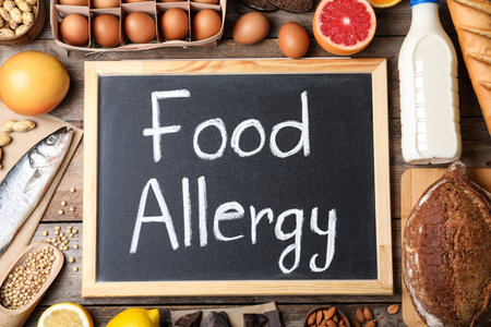 Chalkboard with words FOOD ALLERGY and different products on wooden table, flat layの写真素材