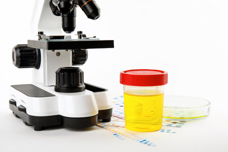 Laboratory ware with urine samples for analysis and microscope on white background