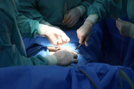 Medical team performing surgery in operating room, closeupの写真素材
