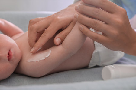 Mother applying moisturizing cream onto baby`s arm on changing table indoors, closeupの写真素材