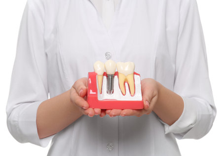 Dentist holding educational model of dental implant on white background, closeupの写真素材