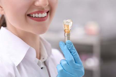 Dentist holding educational model of dental implant indoors, closeup. Space for textの写真素材