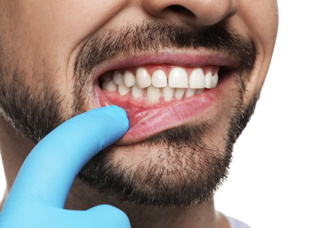 Man showing healthy gums on white background, closeupの写真素材