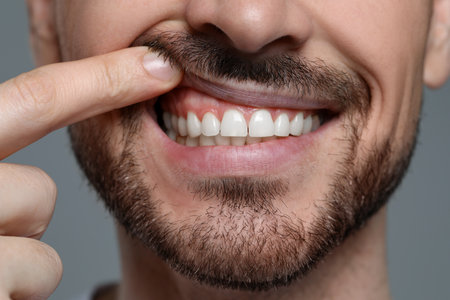 Man showing healthy gums on gray background, closeupの写真素材