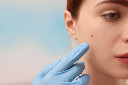 Dermatologist in rubber glove examining patient's birthmark on blurred background, closeupの写真素材