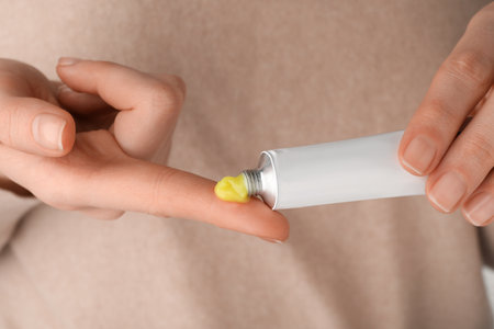 Woman squeezing out ointment from tube on her finger, closeupの写真素材
