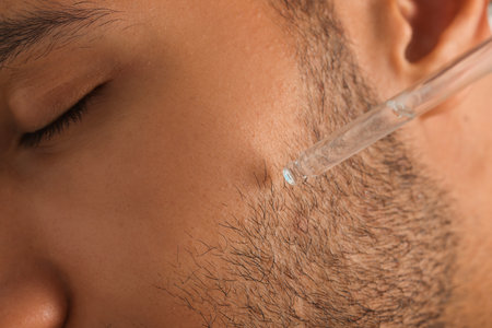 Man applying cosmetic serum onto face, closeup