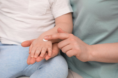 Mother applying ointment onto her son`s hand, closeupの写真素材