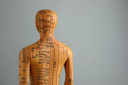 Acupuncture - alternative medicine. Human model with needles in shoulder against gray background, back view. Space for textの写真素材