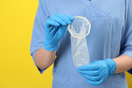 Doctor with unrolled female condom on yellow background, closeup. Safe sexの写真素材