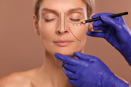 Woman preparing for cosmetic surgery, light brown background. Doctor drawing markings on her face,...