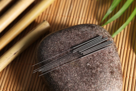 Stone with acupuncture needles on bamboo mat, above viewの写真素材
