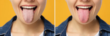Collage with photos of woman before and after tongue cleaning on yellow background, closeup
