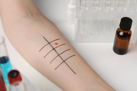 Patient undergoing skin allergy test at light table in clinic, closeup