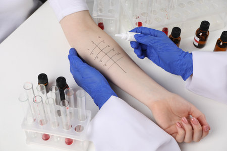 Doctor doing skin allergy test at light table, closeup