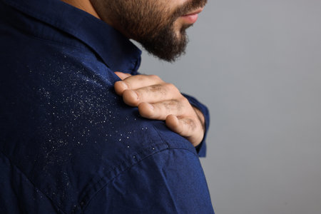 Man brushing dandruff off his shirt on gray background, closeup. Space for textの写真素材
