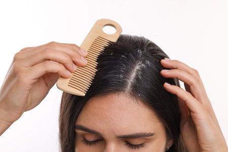 Woman with comb examining her hair and scalp on white background, closeup. Dandruff problemの写真素材
