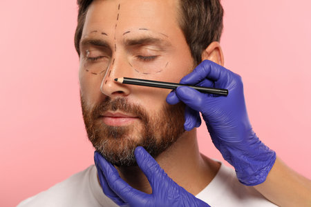Doctor with pencil preparing patient for cosmetic surgery operation on pink background, closeupの写真素材