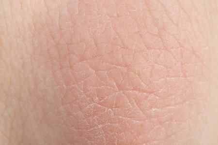 Texture of healthy skin as background, macro viewの写真素材