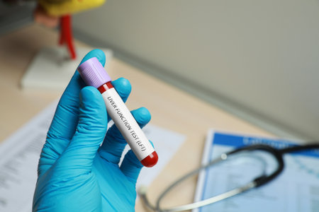 Laboratory worker holding tube with blood sample and label Liver Function Test over table, closeupの写真素材