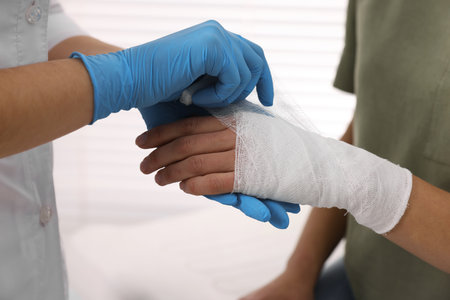 Doctor bandaging patient's burned hand indoors, closeupの写真素材