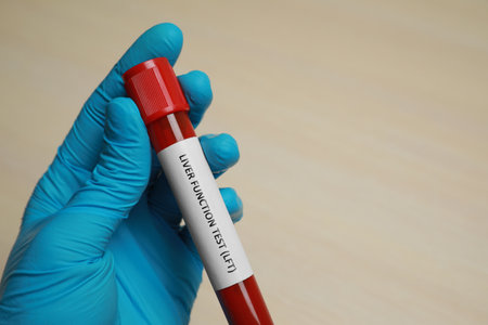 Laboratory worker holding tube with blood sample and label Liver Function Test at beige table, closeup. Space for textの写真素材