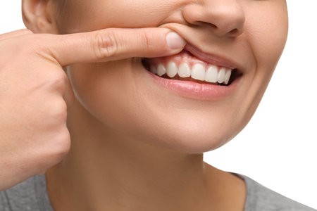 Woman showing her clean teeth on white background, closeup