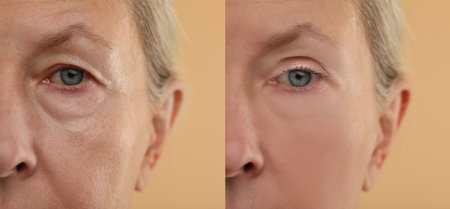 Aging skin changes. Woman showing face before and after rejuvenation, closeup. Collage comparing skin conditionの写真素材