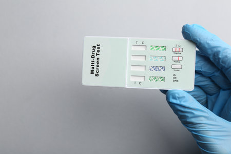 Doctor holding multi-drug screen test on light gray background, top view