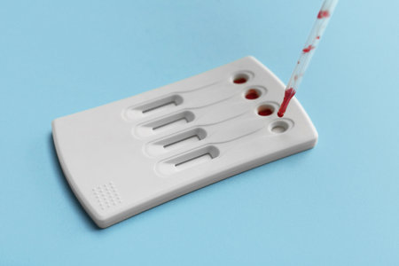 Dropping blood sample onto disposable express test cassette with pipette on light blue background