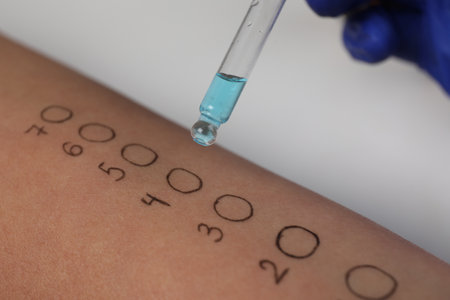 Patient undergoing skin allergy test at light table in clinic, closeupの写真素材