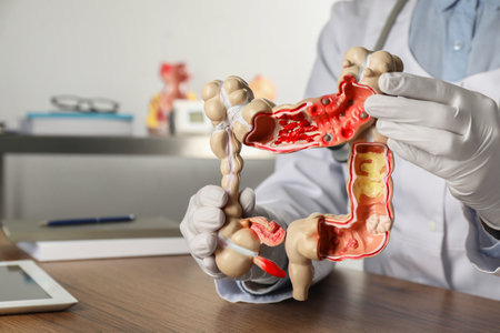 Gastroenterologist with human colon model at table in clinic, closeupの写真素材