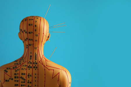 Acupuncture - alternative medicine. Human model with needles in head and shoulder against light blue background, back view. Space for textの写真素材