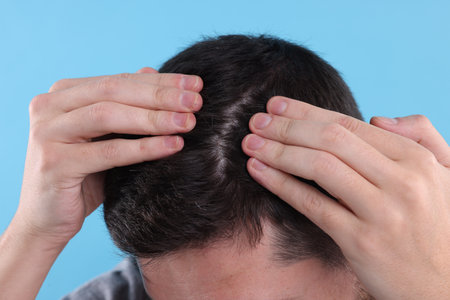 Man examining his hair and scalp on light blue background, closeupの写真素材